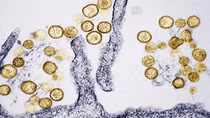 Ổ dịch virus Hanta trên tàu du lịch Đại Tây Dương tăng lên 8 ca, WHO đang truy vết