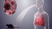 Bộ Y tế cảnh báo khẩn về loại virus lây từ chuột sau chùm ca bệnh tử vong trên tàu du lịch