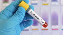 Chưa ghi nhận trường hợp mắc bệnh do virus Nipah tại Việt Nam