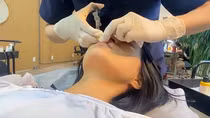 Một cơ sở “thẩm mỹ chui” tiêm filler gây biến chứng
