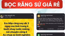 Bọc răng sứ 1 triệu – Giá rẻ hay “cú lừa”?