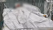 Vụ phóng hỏa 2 người chết tại tỉnh Gia Lai: Bệnh nhi 5 tuổi tạm qua cơn nguy kịch