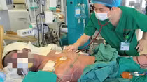 Người đàn ông nguy kịch sau 1 tuần ăn lòng lợn