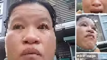 Tái diễn nạn giả bệnh nhân nghèo để xin từ thiện