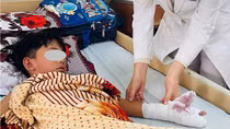 Bé trai bị thương vì mua thuốc nổ về chế pháo