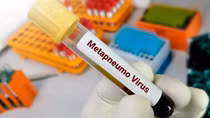Cần cảnh giác, nhưng không hoang mang với bệnh hô hấp do virus HMPV