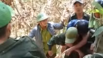 Bị bỏng nặng vì đốt lửa lấy mật ong rừng