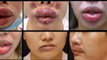 Các cơ sở “lấn sân” là thách thức lớn trong việc đảm bảo an toàn thẩm mỹ