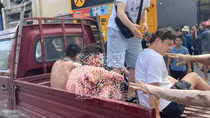 Viện Bỏng Quốc gia: 5 nạn nhân trong vụ nổ ở Vĩnh Phúc đều trong tình trạng rất nặng
