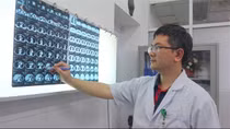Phẫu thuật thành công ca phổi trong phổi đặc biệt hiếm gặp