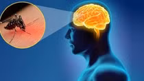 Đắk Lắk ghi nhận ca viêm não Nhật Bản đầu tiên