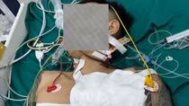 Mâu thuẫn bán hàng, chủ quán cà phê cầm dao chém "đối thủ"