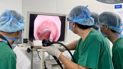 Nội soi lấy móc khóa dây đồng hồ trong tá tràng bệnh nhi ba tuổi