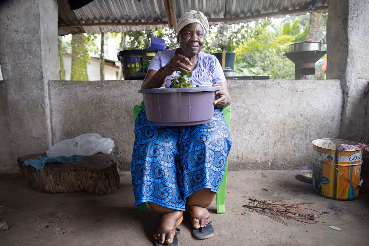 Một phụ nữ Liberia với đôi chân sưng phù, hậu quả của bệnh giun chỉ bạch huyết. Ảnh: Quỹ Anesvad