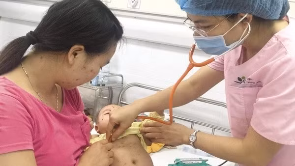 Hà Nội xuất hiện các chùm thuỷ đậu ở trường mầm non