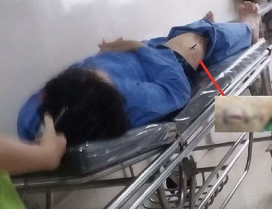 Đối tượng đâm cán bộ Cục thuế Ninh Bình khai gì tại cơ quan Công an? -0
