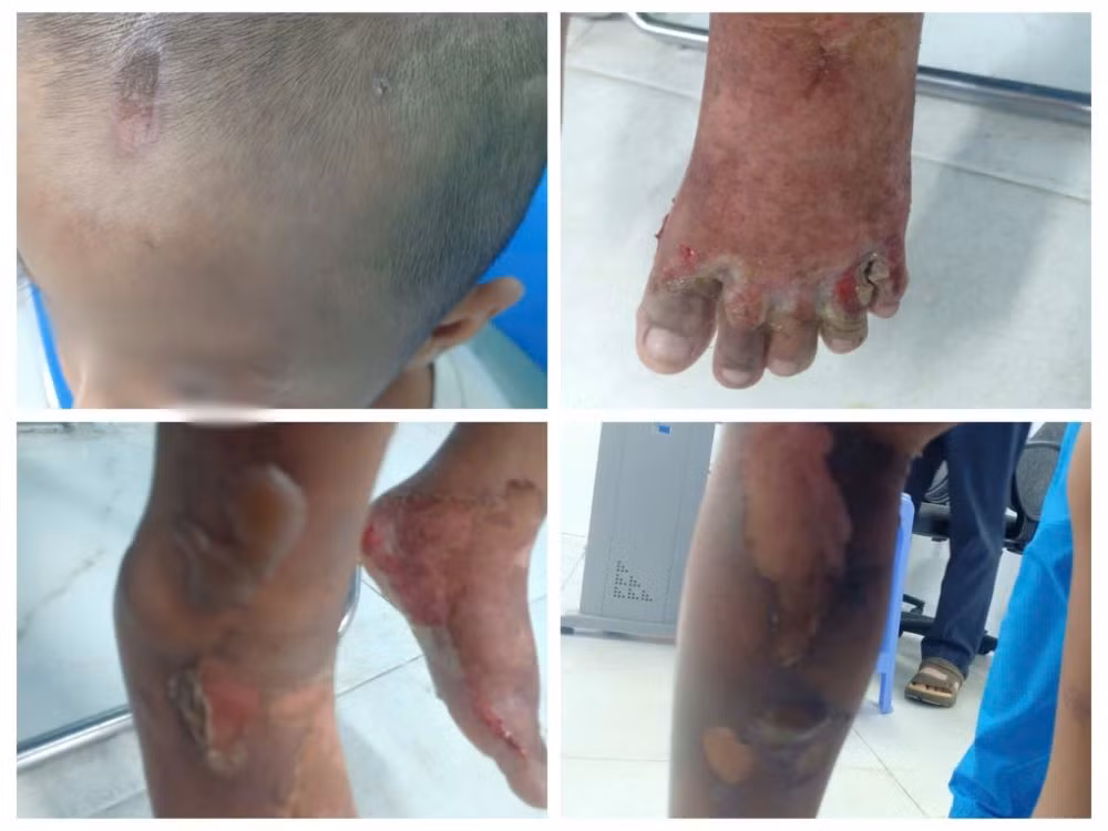 Bắt tạm giam cha ruột và người yêu trong vụ bé 6 tuổi bị bạo hành -0