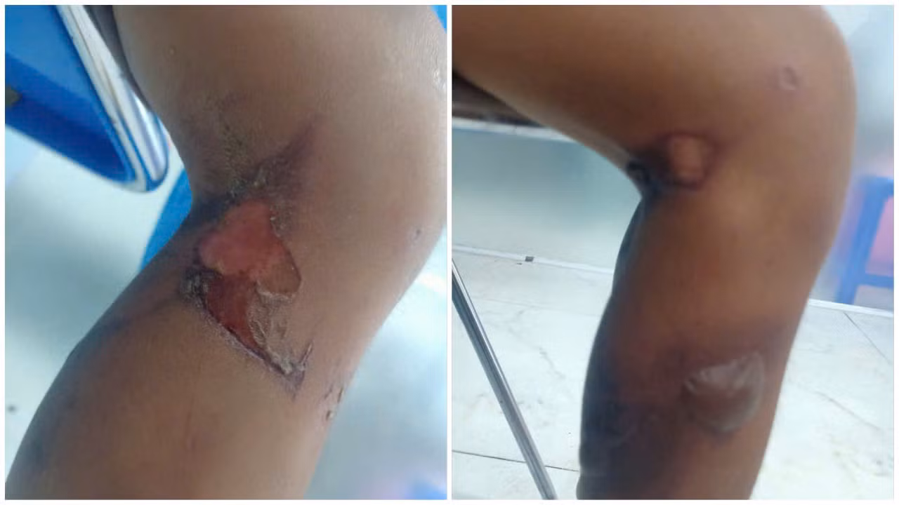 Vụ bé 6 tuổi bị bạo hành: Lời khai gây phẫn nộ của cha ruột -0