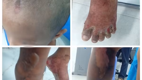 Truy tìm cha của bé trai 6 tuổi nghi bị bạo hành để làm rõ vụ việc