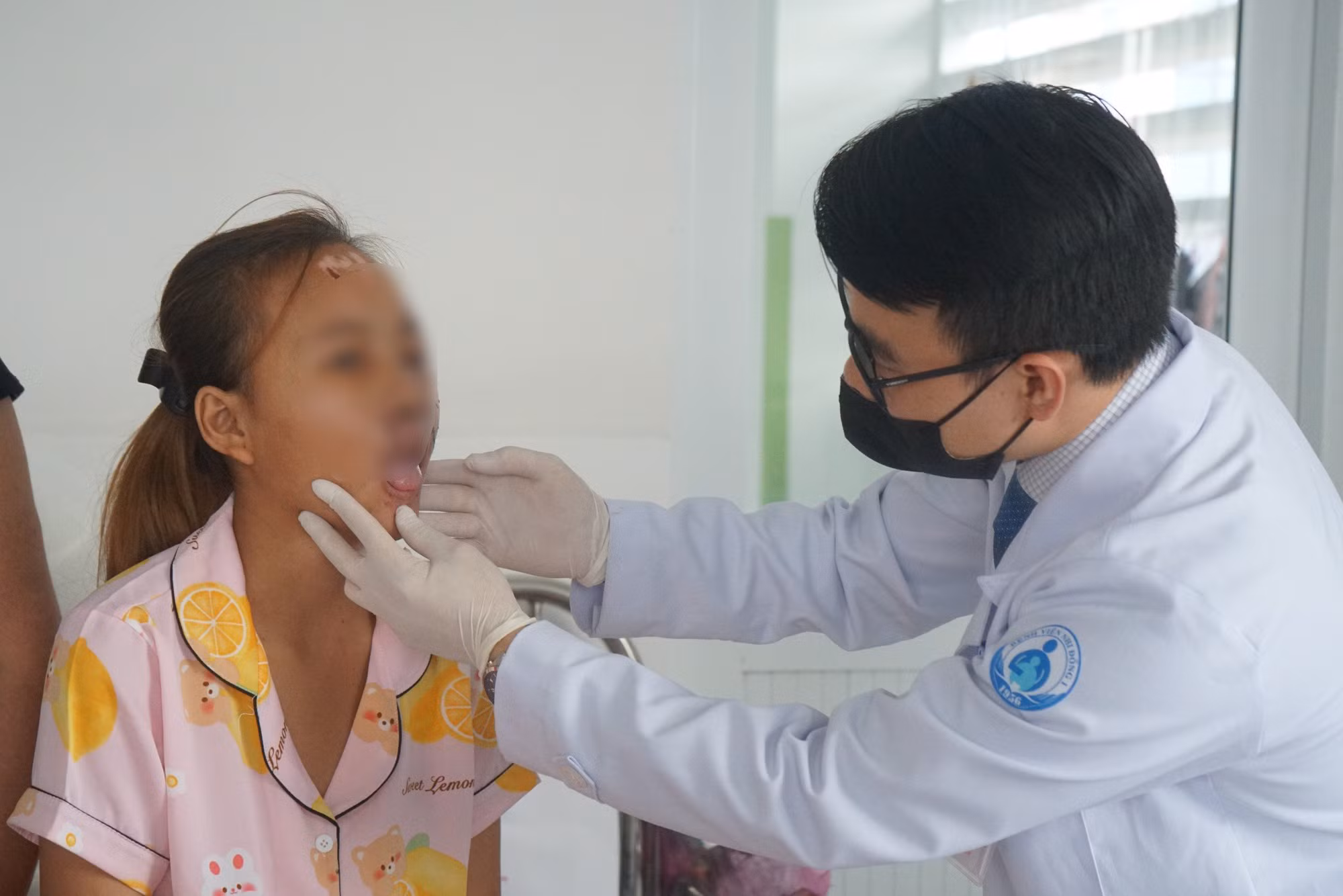 15 tuổi tham gia giao thông, bệnh nhi gặp tai nạn nát nửa mặt -0
