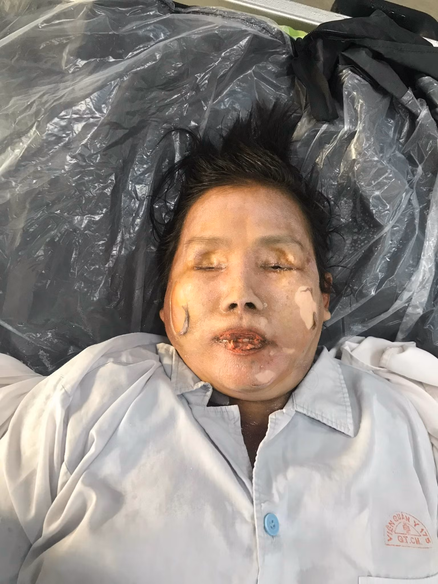 Tìm người nhà cho nữ bệnh nhân vô danh -0