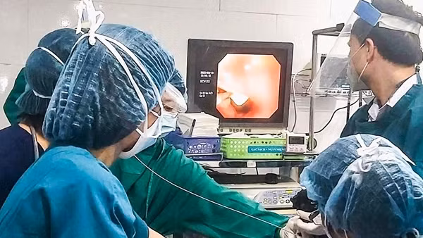 Cứu sống bé trai 16 tháng tuổi té ngã nuốt dị vật 1cm vào dạ dày