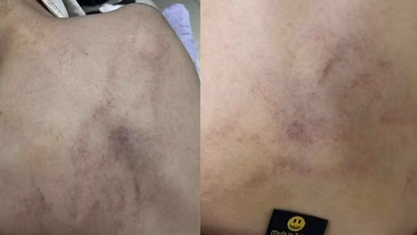 Điều tra vụ bé gái 4 tuổi bị giáo viên mầm non đánh đập, kéo lê, ném vào tường