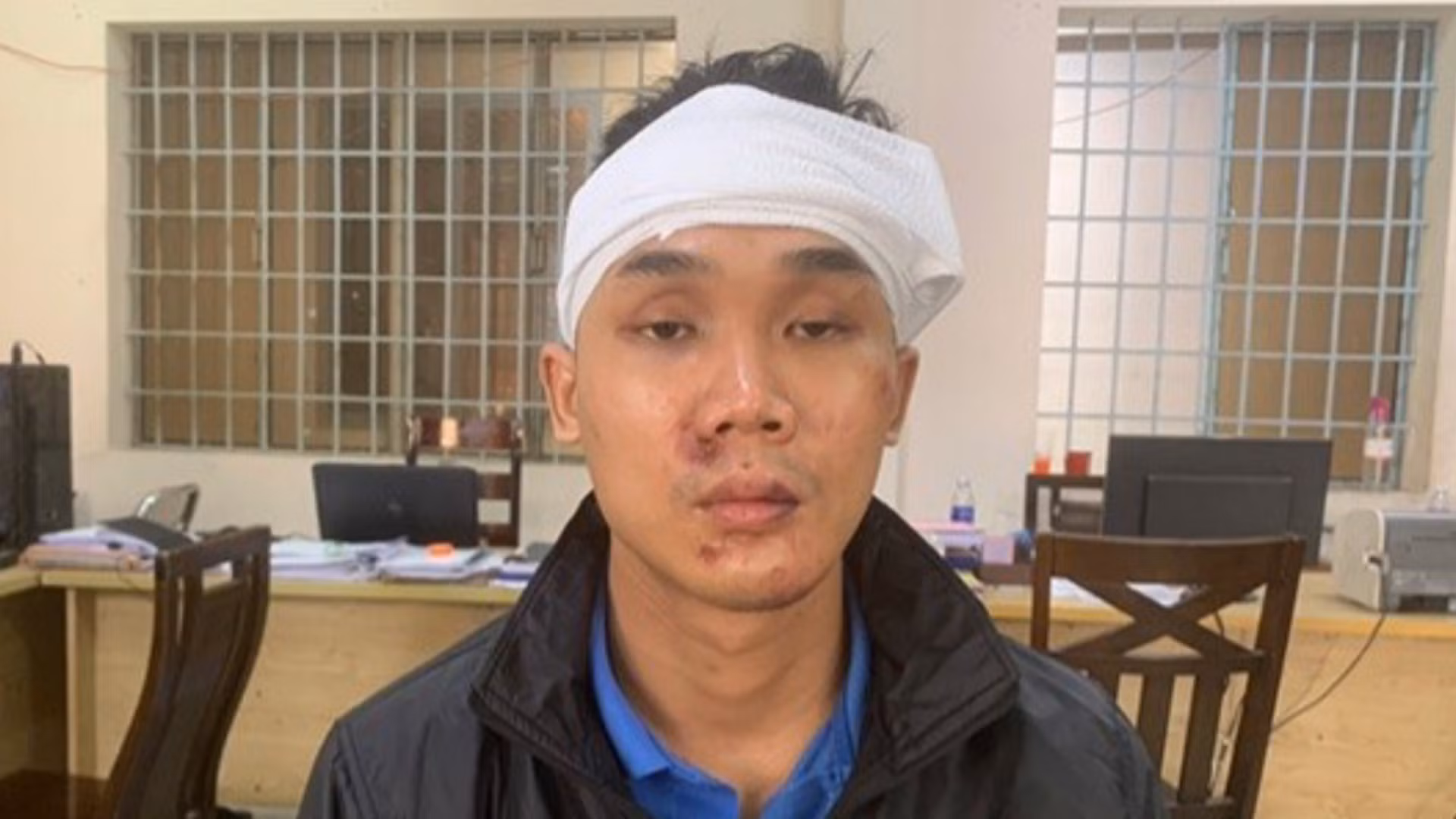 Khởi tố đối tượng đâm trọng thương Phó Công an phường -0