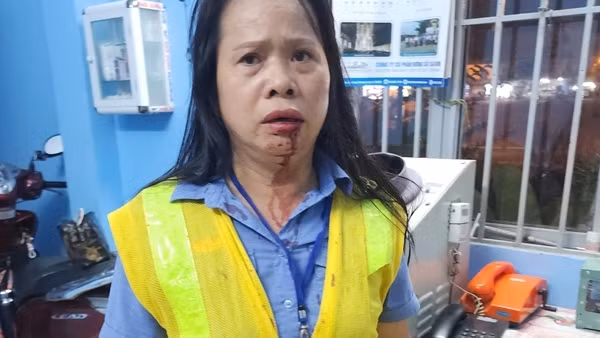 Nhắc người dân chấp hành luật giao thông, một nhân viên đường sắt bị đánh gãy xương mũi