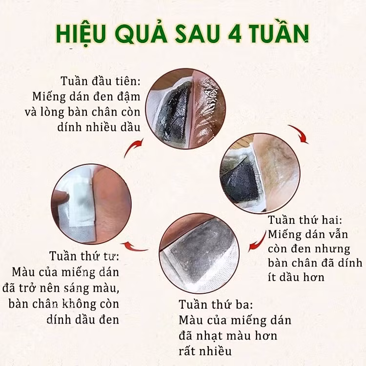 Thực hư công dụng thần kỳ của “miếng dán thải độc” -0
