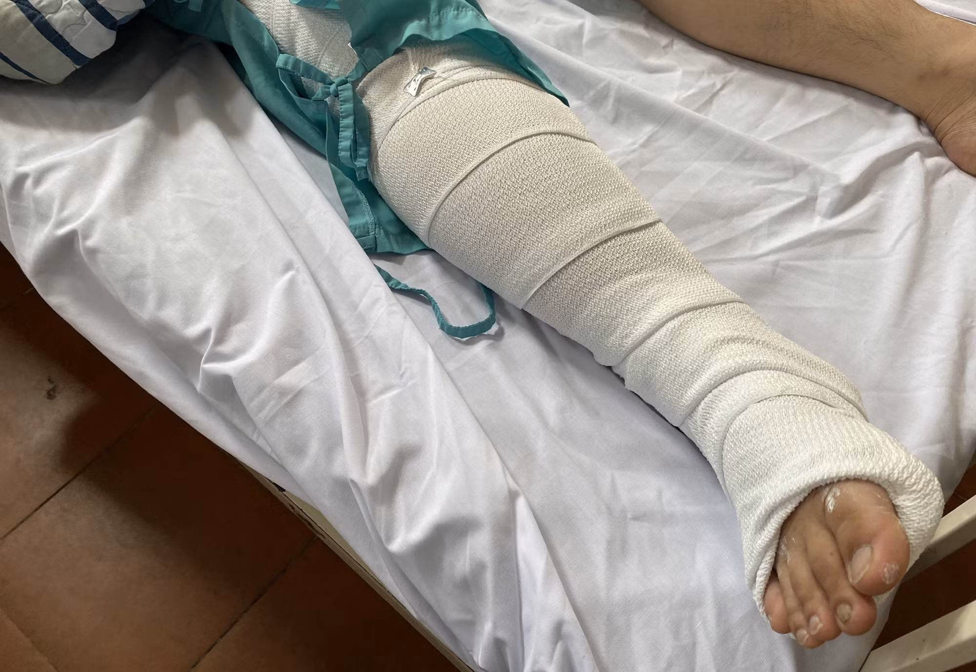 Cục CSGT thăm hỏi Đại úy Công an bị đối tượng say xỉn tông gãy chân -0