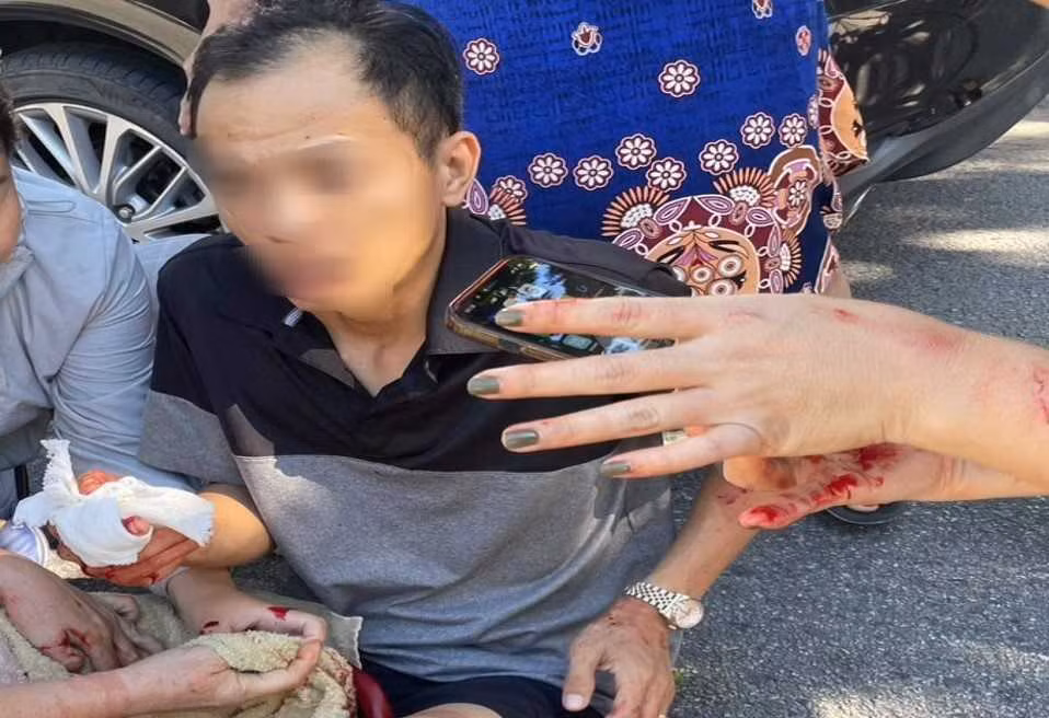 Thành viên một công ty khai thác mỏ bị chém trước nhà riêng -0