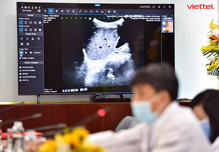 Hơn 1.800 ca COVID-19 nặng đã được hội chẩn quan nền tảng Telehealth -0