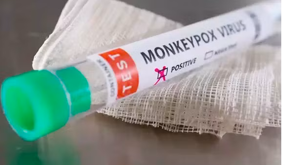 Xây dựng kịch bản, tổ chức diễn tập, sẵn sàng đáp ứng với bệnh đậu mùa khỉ
