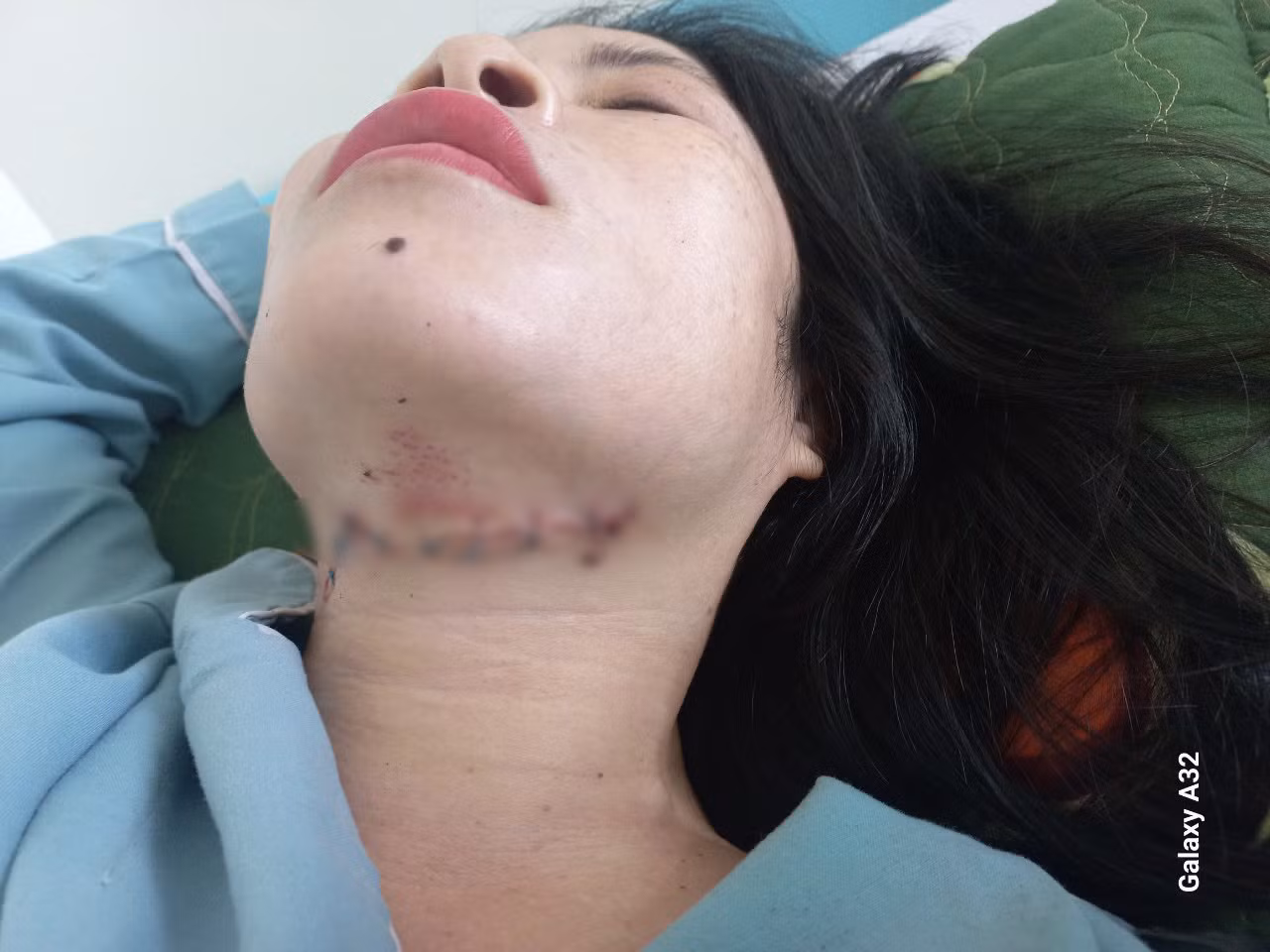 Chém vợ cũ gần đứt chân, con trai vào can ngăn cũng bị chém gây thương tích -0