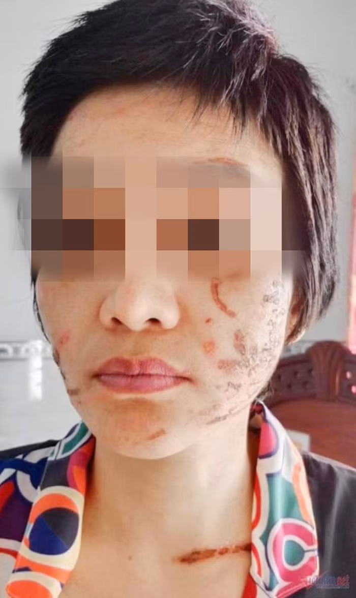 Đêm trường của người vợ bầu bị bạo hành -0