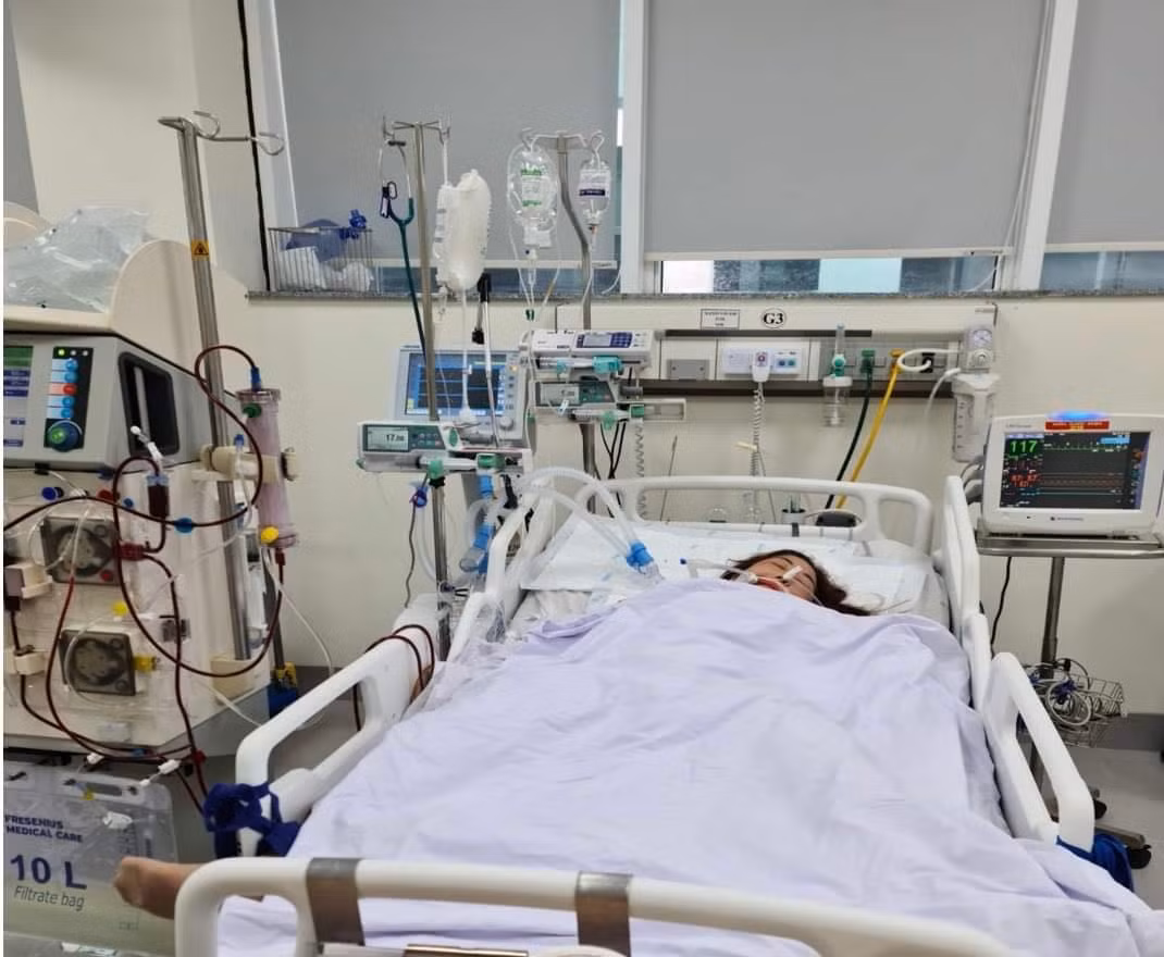 Cứu người phụ nữ làm nghề giết mổ nhiễm liên cầu lợn suýt tử vong -0