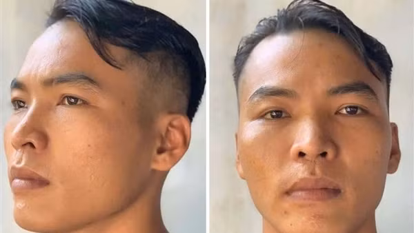 Đối tượng mua bán trái phép chất ma túy trốn khỏi nơi giam giữ