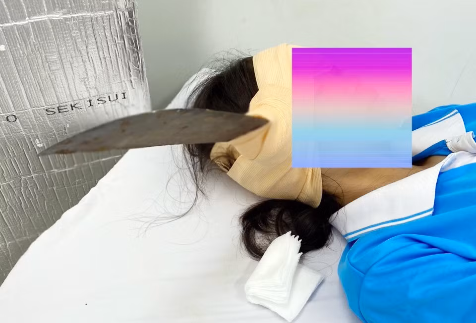 Nữ sinh đang ngồi uống nước, bất ngờ lưỡi dao găm vào đầu -0