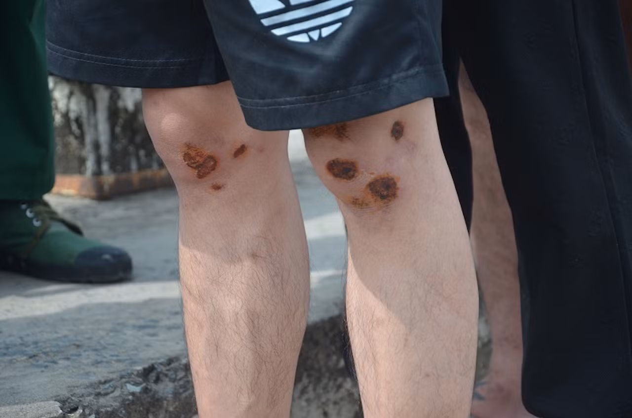 Nước mắt nạn nhân vì tin “việc nhẹ lương cao” rơi vào cạm bẫy nơi xứ người -0