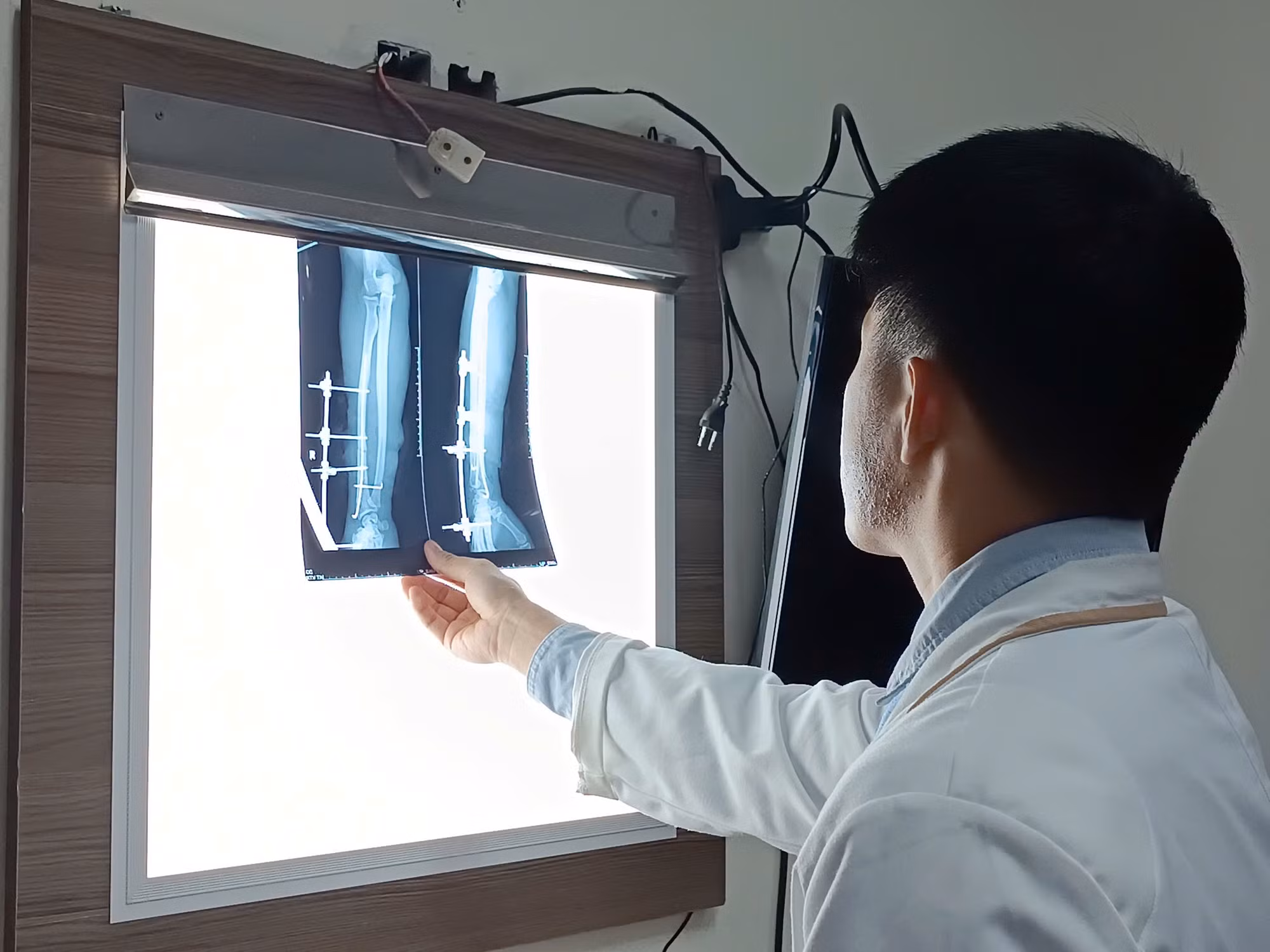 Máy cuốn đứt lìa cẳng tay nam công nhân trong lúc làm việc -2