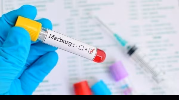 Giám sát chặt nguy cơ lây lan virus Marburg vào Việt Nam