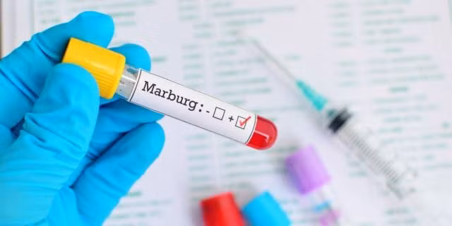 Giám sát chặt nguy cơ lây lan virus Marburg vào Việt Nam -0