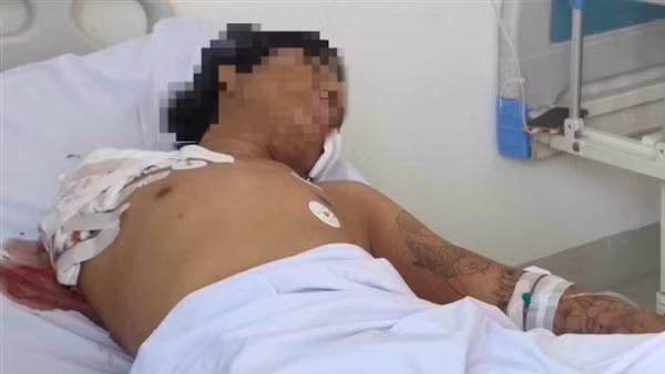 Chém đứt lìa cánh tay vì lái xe nẹt pô khiêu khích