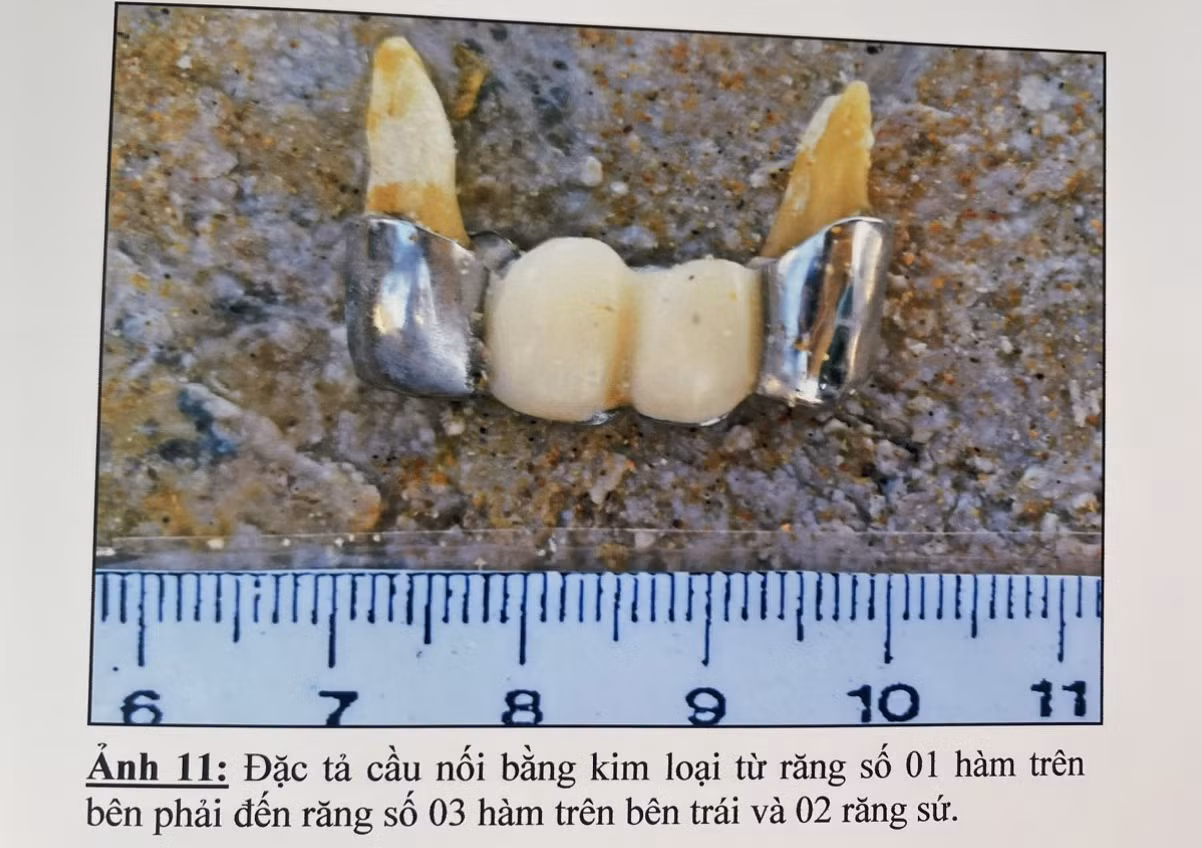  Cơ quan CSĐT Công an tỉnh Phú Yên truy tìm tung tích nạn nhân -0