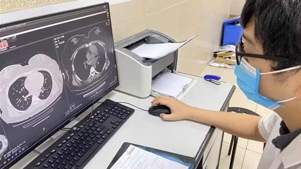 Hoại tử xương sọ mặt có phải do “hậu COVID-19” hay không? ảnh 3