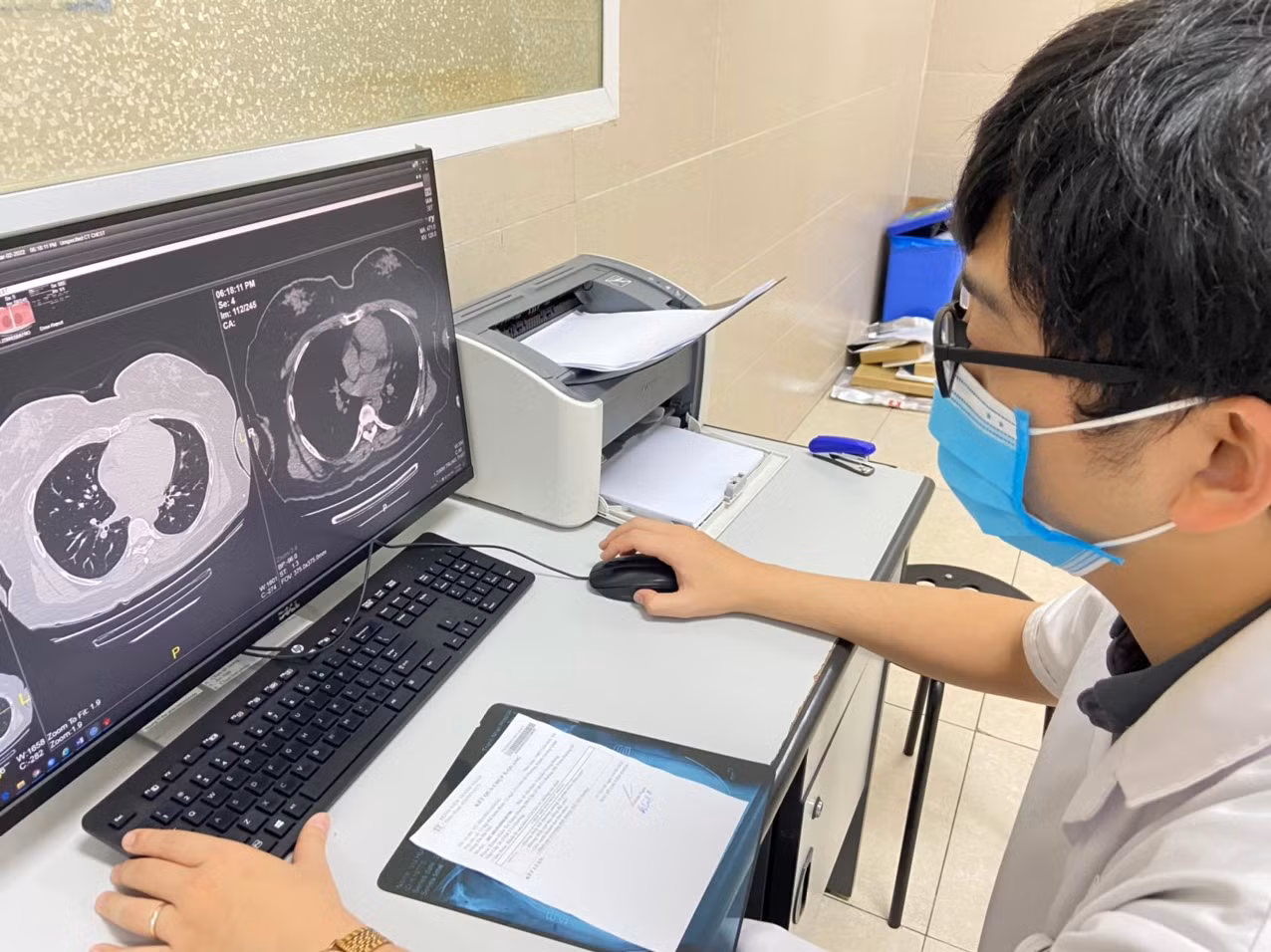 Những việc cần làm để tránh “sương mù não” hậu COVID-19 -0