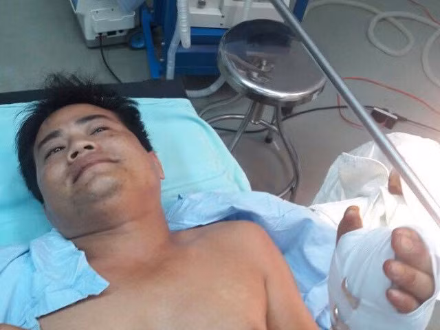 Hiểm họa khôn lường từ “súng bút” tự chế -0