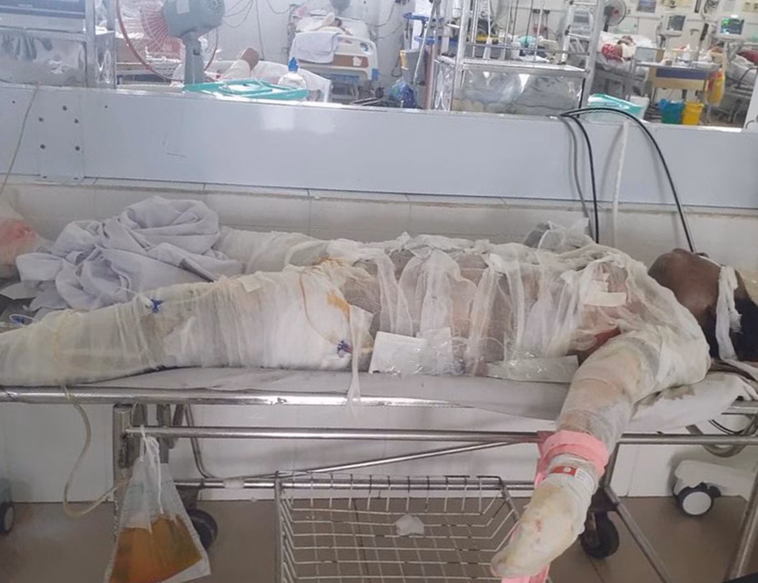 5 người thương vong từ vụ chủ nhà mua xăng đốt phòng ngủ -0