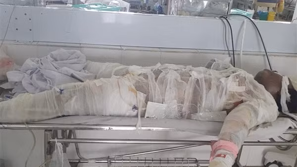 Năm người thương vong từ vụ chủ nhà dùng xăng đốt phòng ngủ